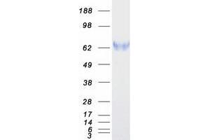 Validation with Western Blot