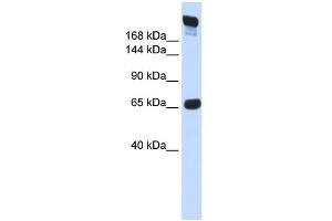 WB Suggested Anti-SI Antibody Titration:  0. (SI 抗体  (N-Term))