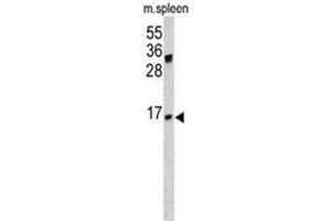 Western blot analysis of IGJ antibody (N-term) in mouse spleen lysates (35ug/lane).