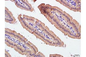 Immunohistochemistry (Paraffin-embedded Sections) (IHC (p)) image for anti-Solute Carrier Family 30 (Zinc Transporter), Member 1 (SLC30A1) (AA 131-330) antibody (ABIN1386095)