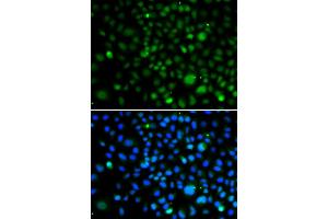 Immunofluorescence analysis of A549 cells using KLF15 antibody. (KLF15 抗体)