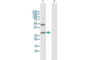 Western Blot analysis of NOG expression in transfected 293T cell line by NOG MaxPab polyclonal antibody. (NOG 抗体  (AA 1-232))