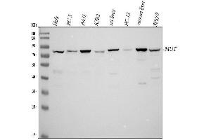 Western blot analysis of MUT using anti-MUT antibody (ABIN4886676). (MUT 抗体  (N-Term))