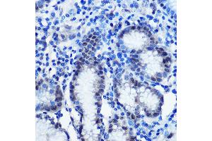 Immunohistochemistry of paraffin-embedded human stomach using BRD4 Rabbit pAb (ABIN7265946) at dilution of 1:100 (40x lens). (BRD4 抗体  (AA 700-794))