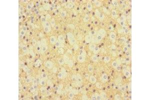 Immunohistochemistry of paraffin-embedded human adrenal gland tissue using ABIN7157290 at dilution of 1:100 (KLHL3 抗体  (AA 1-301))