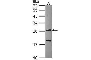 Western Blotting (WB) image for anti-Glutathione S-Transferase alpha 1 (GSTA1) antibody (ABIN2856555)