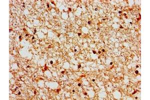 Immunohistochemistry of paraffin-embedded human brain tissue using ABIN7169471 at dilution of 1:100 (SH3TC2 抗体  (AA 188-427))