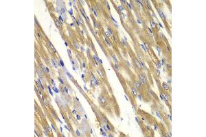Immunohistochemistry of paraffin-embedded rat heart using TYR antibody at dilution of 1:100 (400x lens). (TYR 抗体)