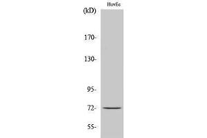 Western Blotting (WB) image for anti-Cell Division Cycle 16 Homolog (S. Cerevisiae) (CDC16) (Tyr405) antibody (ABIN3183796) (CDC16 抗体  (Tyr405))