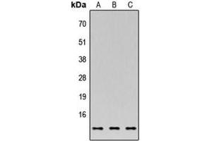 Western blot analysis of C35 expression in MCF7 (A), NS-1 (B), PC12 (C) whole cell lysates. (C17orf37 抗体  (C-Term))