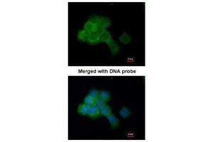 ICC/IF Image Immunofluorescence analysis of paraformaldehyde-fixed A431, using eEF-2K, antibody at 1:200 dilution. (EEF2K 抗体  (N-Term))