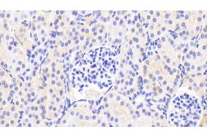 Detection of APOD in Human Kidney Tissue using Polyclonal Antibody to Apolipoprotein D (APOD) (Apolipoprotein D 抗体  (AA 21-189))