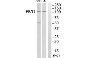 Western Blotting (WB) image for anti-Protein Kinase N1 (PKN1) (Internal Region) antibody (ABIN1852725) (PKN1 抗体  (Internal Region))