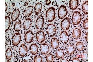 Immunohistochemistry (IHC) analysis of paraffin-embedded Human Colon, antibody was diluted at 1:100. (CACYBP 抗体  (C-Term))