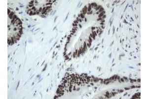 Image no. 4 for anti-Splicing Factor 3a, Subunit 1 (SF3A1) (AA 249-568) antibody (ABIN1491272) (SF3A1 抗体  (AA 249-568))