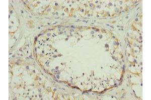 Immunohistochemistry of paraffin-embedded human testis tissue using ABIN7170536 at dilution of 1:100 (SPZ1 抗体  (AA 181-430))
