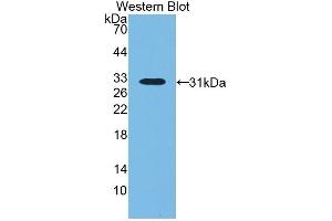 Detection of Recombinant LBP, Bovine using Polyclonal Antibody to Lipopolysaccharide Binding Protein (LBP) (LBP 抗体  (AA 224-468))