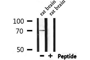 Western blot analysis of extracts from rat brain, using PROS1 Antibody. (PROS1 抗体  (N-Term))