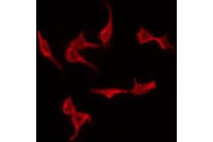 Immunofluorescence (fixed cells) (IF/ICC) image for anti-Tumor Protein P53 (TP53) (pSer315) antibody (ABIN6256267)