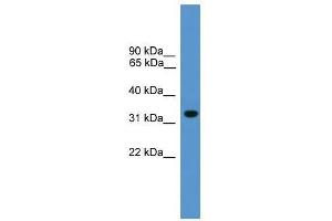 Western Blot showing BNIP1 antibody used at a concentration of 1-2 ug/ml to detect its target protein. (BNIP1 抗体  (N-Term))