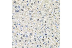 Immunohistochemistry (Paraffin-embedded Sections) (IHC (p)) image for anti-Solute Carrier Family 3 (Activators of Dibasic and Neutral Amino Acid Transport), Member 2 (SLC3A2) (AA 360-529) antibody (ABIN6148000)