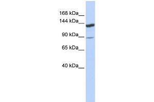 WB Suggested Anti-TRIM24 Antibody Titration:  0. (TRIM24 抗体  (Middle Region))