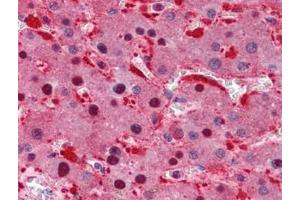 Human Liver: Formalin-Fixed, Paraffin-Embedded (FFPE) (Isocitrate Dehydrogenase 抗体)