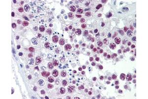 Immunohistochemistry (IHC) image for anti-SRY (Sex Determining Region Y)-Box 4 (SOX4) (N-Term) antibody (ABIN2780469)