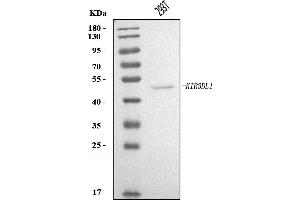 Western blot analysis of KIR3DL1 using anti-KIR3DL1 antibody (ABIN7600956).
