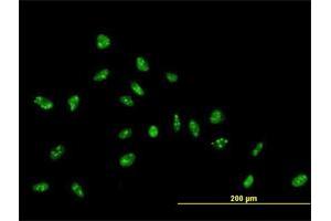 Immunofluorescence of purified MaxPab antibody to ZNF593 on HeLa cell. (ZNF593 抗体  (AA 1-116))