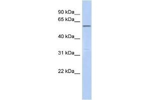 WB Suggested Anti-C6orf182 Antibody Titration: 0. (CEP57L1 抗体  (Middle Region))