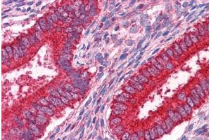 Human Uterus: Formalin-Fixed, Paraffin-Embedded (FFPE) (JUP 抗体  (AA 1-746))