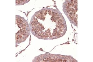 Immunohistochemistry of paraffin-embedded rat testis using NCK11 Rabbit mAb (ABIN7268834) at dilution of 1:100 (40x lens). (NCK1 抗体)