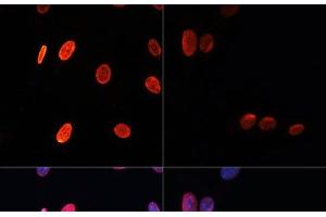 Immunofluorescence analysis of NIH/3T3 cells using Acetyl-Histone H3-K56 Polyclonal Antibody at dilution of 1:100. (Histone 3 抗体  (acLys56))