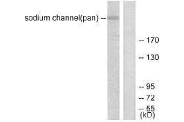 SCN5A 抗体