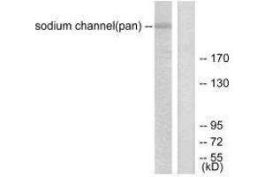 Western blot analysis of extracts from HuvEc cells, using Sodium Channel-pan antibody. (SCN5A 抗体)