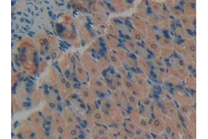 DAB staining on IHC-P; Samples: Mouse Stomach Tissue (PKC delta 抗体  (AA 328-674))