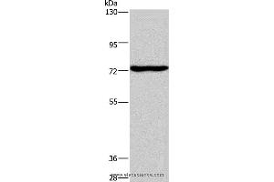 Western blot analysis of Mouse brain tissue, using KCND1 Polyclonal Antibody at dilution of 1:400 (KCND1 抗体)