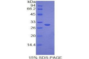SDS-PAGE (SDS) image for Myosin IE (MYO1E) (AA 772-1033) protein (His tag) (ABIN2121692) (MYO1E Protein (AA 772-1033) (His tag))