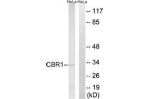 Western blot analysis of extracts from HeLa cells, using CBR1 Antibody. (CBR1 抗体  (AA 181-230))