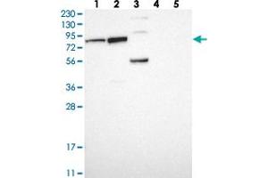 Western blot analysis of Lane 1: RT-4, Lane 2: U-251 MG, Lane 3: Human Plasma, Lane 4: Liver, Lane 5: Tonsil with PUS7 polyclonal antibody  at 1:250-1:500 dilution. (PUS7 抗体)