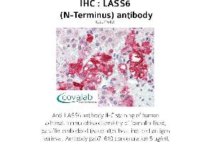 Image no. 1 for anti-Ceramide Synthase 6 (CERS6) (N-Term) antibody (ABIN1736367) (CERS6 抗体  (N-Term))