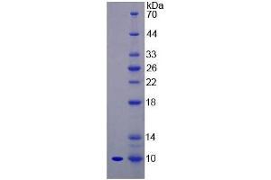 SDS-PAGE of Protein Standard from the Kit (Highly purified E. (Insulin ELISA 试剂盒)
