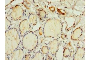 Immunohistochemistry (IHC) image for anti-Oxidative Stress Induced Growth Inhibitor Family Member 2 (OSGIN2) (AA 1-250) antibody (ABIN7162370)