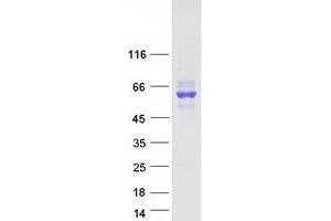 Western Blotting (WB) image for Carboxylesterase 2 (CES2) (Transcript Variant 2) protein (Myc-DYKDDDDK Tag) (ABIN2713933)