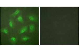 Immunofluorescence analysis of HeLa cells, treated with Forskolin (40nM, 30mins), using JAB1 antibody (ABIN5976433). (COPS5 抗体  (Internal Region))