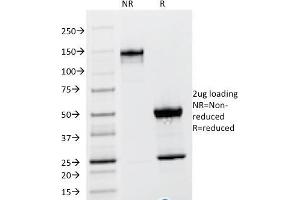 SDS-PAGE Analysis Purified TSH beta Mouse Monoclonal Antibody (TSHb/1317). (TSHB 抗体)