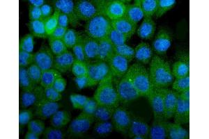 IF analysis of ITGA8 using anti-ITGA8 antibody (ABIN7601411).
