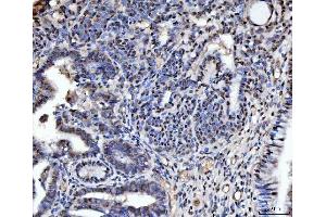 IHC analysis of TIGD1 using anti-TIGD1 antibody (ABIN7602407).