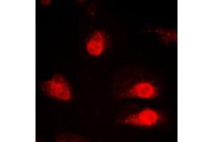 Immunofluorescent analysis of hnRNP Q staining in HeLa cells. (SYNCRIP 抗体  (Center))